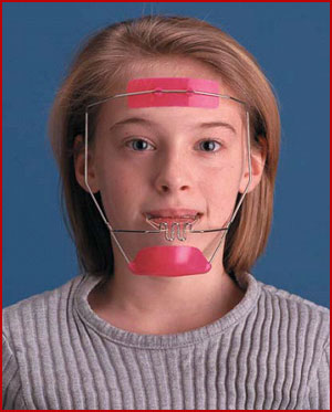 headgear, reverse pull