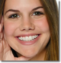 girl with clear braces, porcelain braces